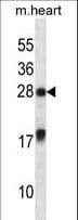 MXI1 / MAD2 Antibody (aa53-82)