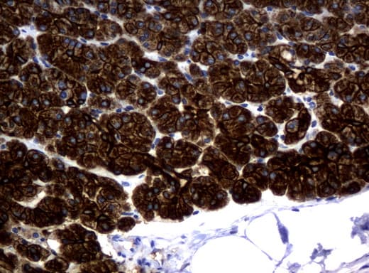 Monoclonal Mouse anti-Human KRT18 / CK18 / Cytokeratin 18 Antibody (clone UMAB50, Carrier-free, aa69-372, IHC, IF, WB)