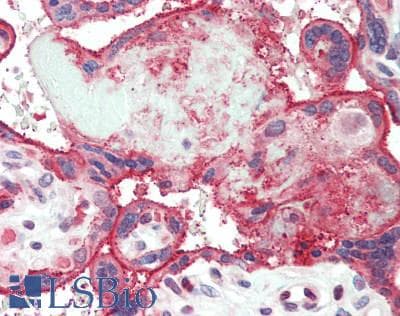 Polyclonal Rabbit anti-Human PSEN2 / Presenilin 2 Antibody (aa32-65, IHC, WB)