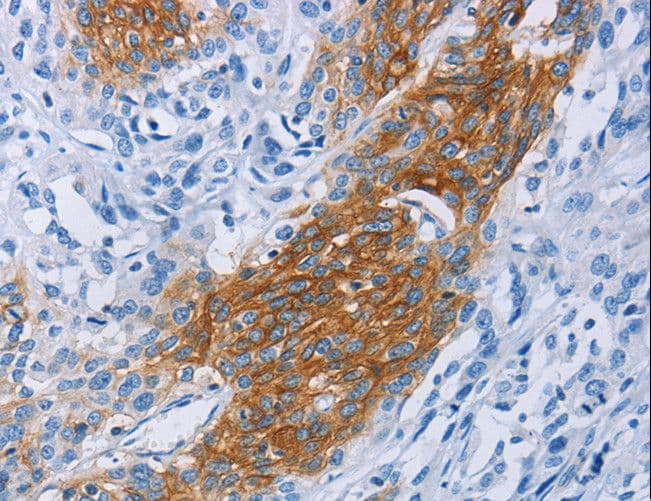 CCR9 / CD199 Antibody