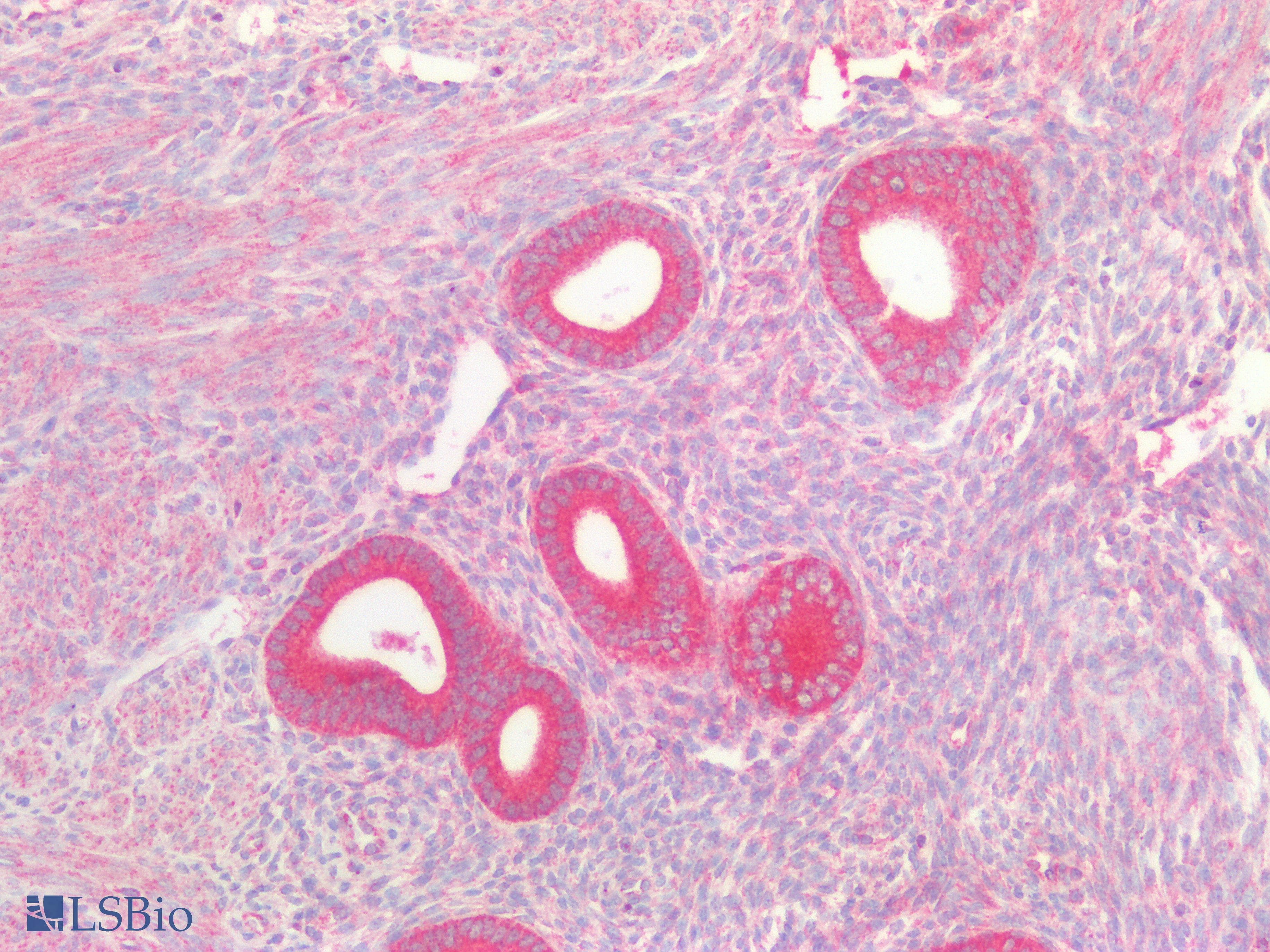 PathPlus™ Polyclonal Rabbit anti-Human RRM2B / P53R2 Antibody (IHC, IF, WB)