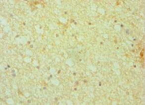 Polyclonal Rabbit anti-Human DCTN1 / Dynactin 1 Antibody (aa1084-1278, IHC, WB)