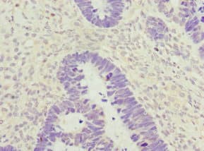 Polyclonal Rabbit anti-Human ZWINT Antibody (IHC, WB)
