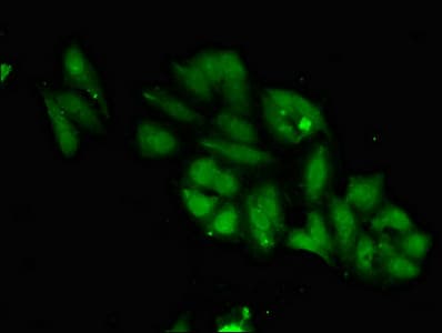 Polyclonal Rabbit anti-Human MPS1 / TTK Antibody (IHC, IF)
