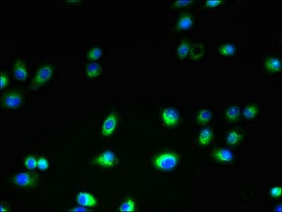 Polyclonal Rabbit anti-Human TMEM106A Antibody