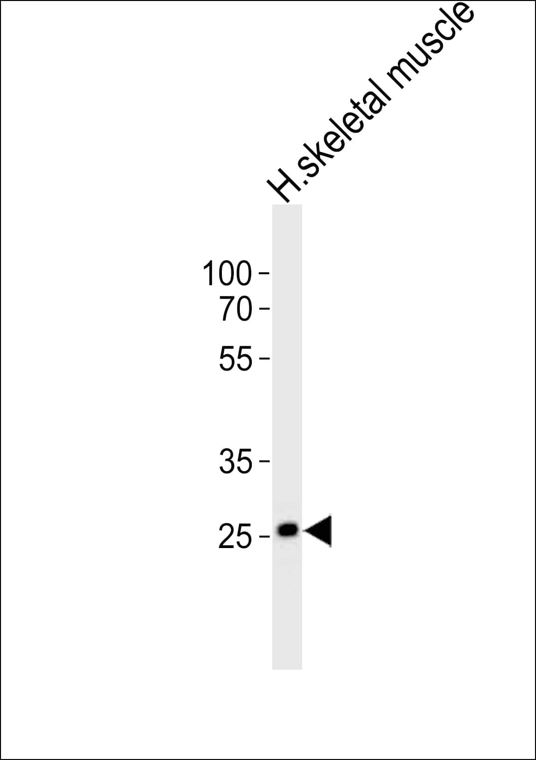 OLIG3 Antibody (aa161-196)