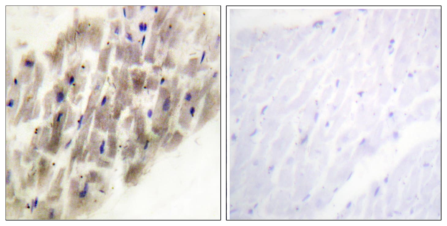 Polyclonal Rabbit anti-Human MAPKAPK2 / MAPKAP Kinase 2 Antibody (phospho-Thr222, IHC, WB)