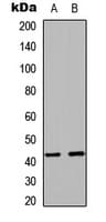 Polyclonal Rabbit anti-Human RAD51C Antibody (Internal, IHC, IF, WB)