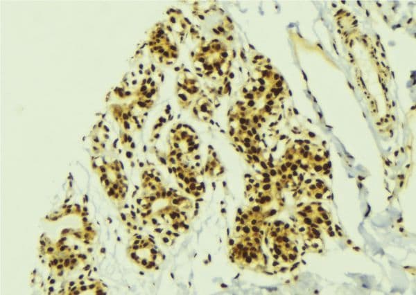 Polyclonal Rabbit anti-Human GLI2 Antibody (IHC, IF, WB)