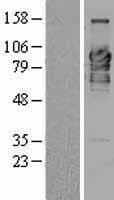 KIAA1984 / PARF Protein (Over-Expression Lysate Myc-DDK (Flag))