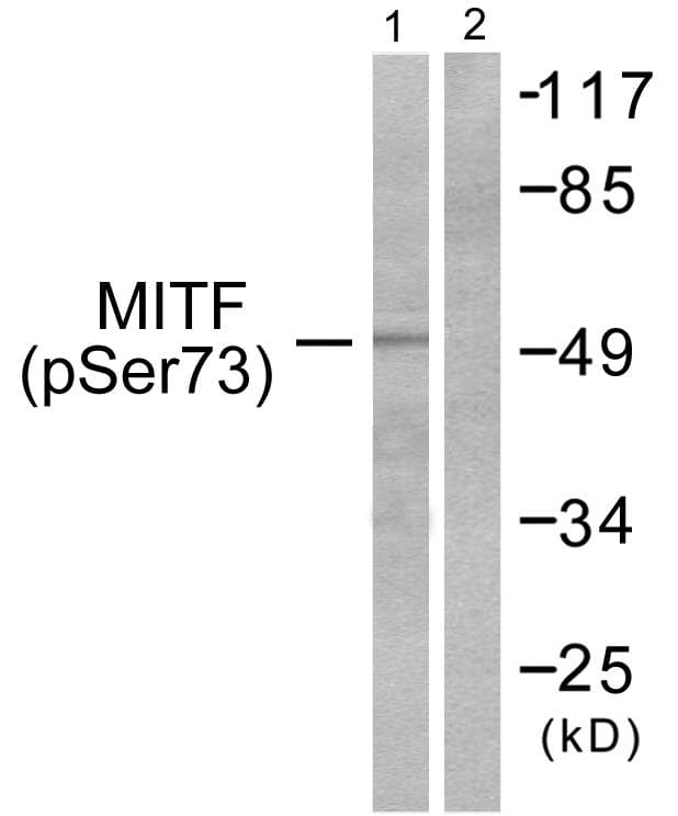 Polyclonal Rabbit anti-Human MITF Antibody (phospho-Ser180/73, WB)