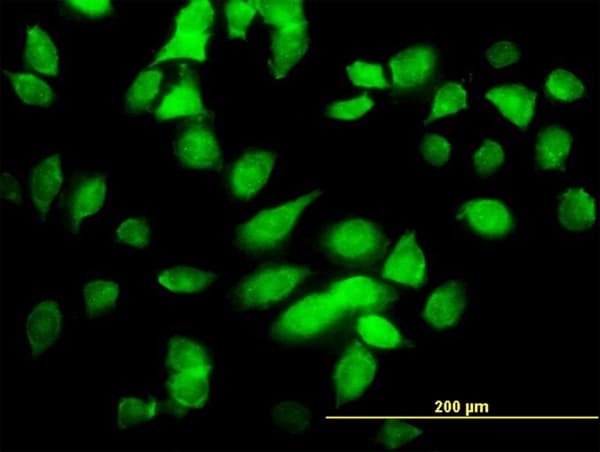 CHUK / IKKA / IKK Alpha Antibody (clone 4B8)