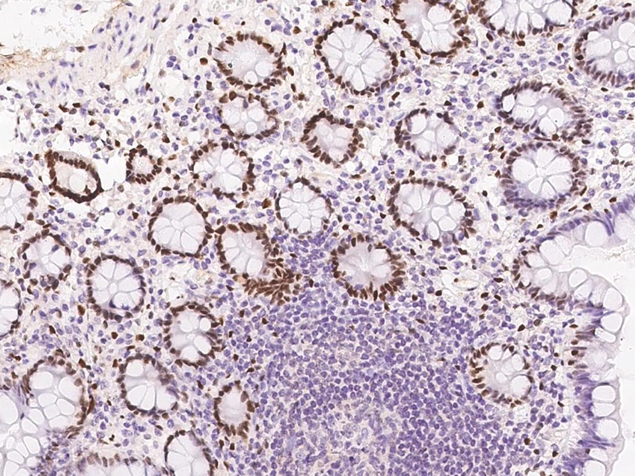 DACH / DACH1 Antibody