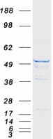 Human TUBB3 / Tubulin Beta 3 Protein (Recombinant Myc-DDK (Flag))