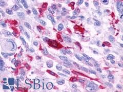 PathPlus™ GPR39 Antibody (Extracellular Domain)