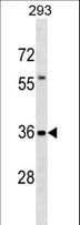 Polyclonal Rabbit anti-Human TFG Antibody (aa184-212, WB)