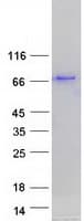 Human PALM2 Protein (Recombinant Myc-DDK (Flag))