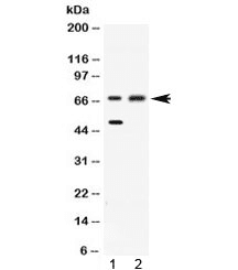 ACADVL Antibody