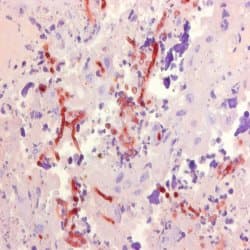 Monoclonal Mouse anti-Fungus Aspergillus Antibody (clone WF-AF-1, IHC, WB)