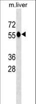CAT / Catalase Antibody (aa152-180)