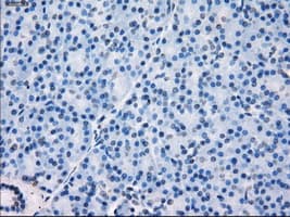 Monoclonal Mouse anti-Human GBP2 Antibody (clone OTI1E5, IHC, IF, WB)