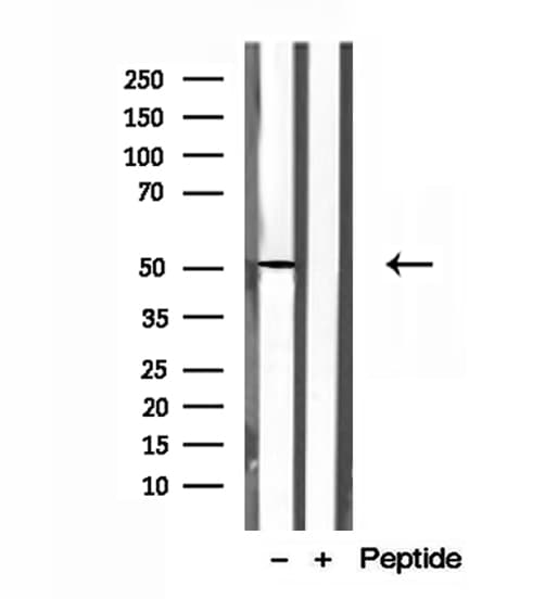 NR1H2 / LXR Beta Antibody