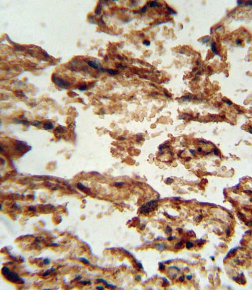 IGFBP4 Antibody (aa96-124)