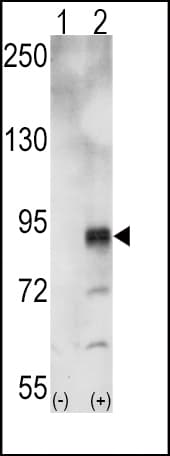 EPHA5 / EPH Receptor A5 Antibody