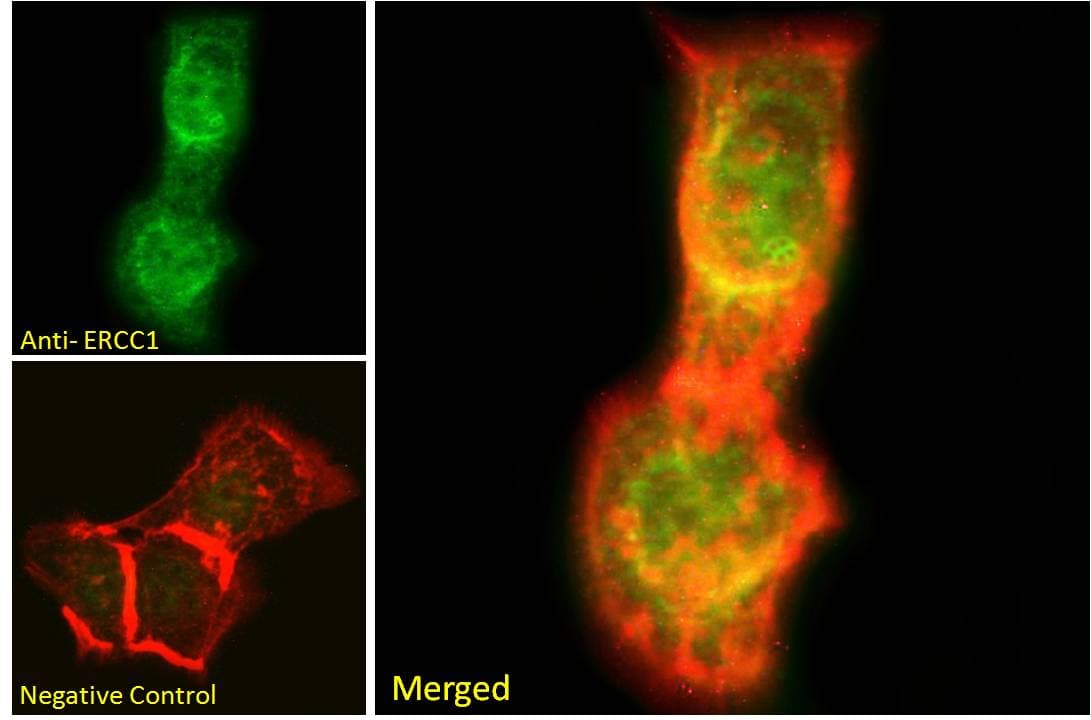 IHC-plus™ ERCC1 Antibody (aa172-184)