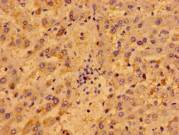 P2RY1 / P2Y1 Antibody