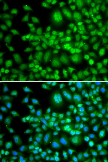 Polyclonal Rabbit anti-Human SETD5 Antibody (IHC, IF, WB)