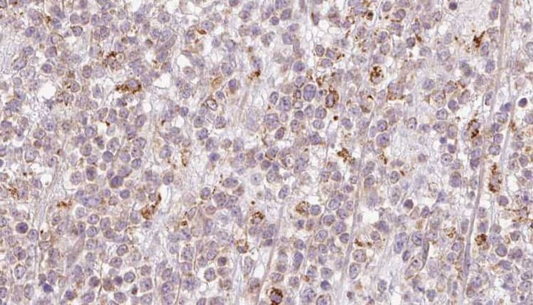 CCDC93 Antibody