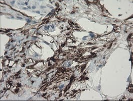 F13A1 / Factor XIIIa Antibody (clone OTI3E3, Carrier-free)