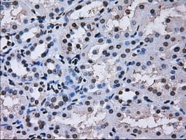 RPA2 / RFA2 / RPA34 Antibody (clone OTI1H10)