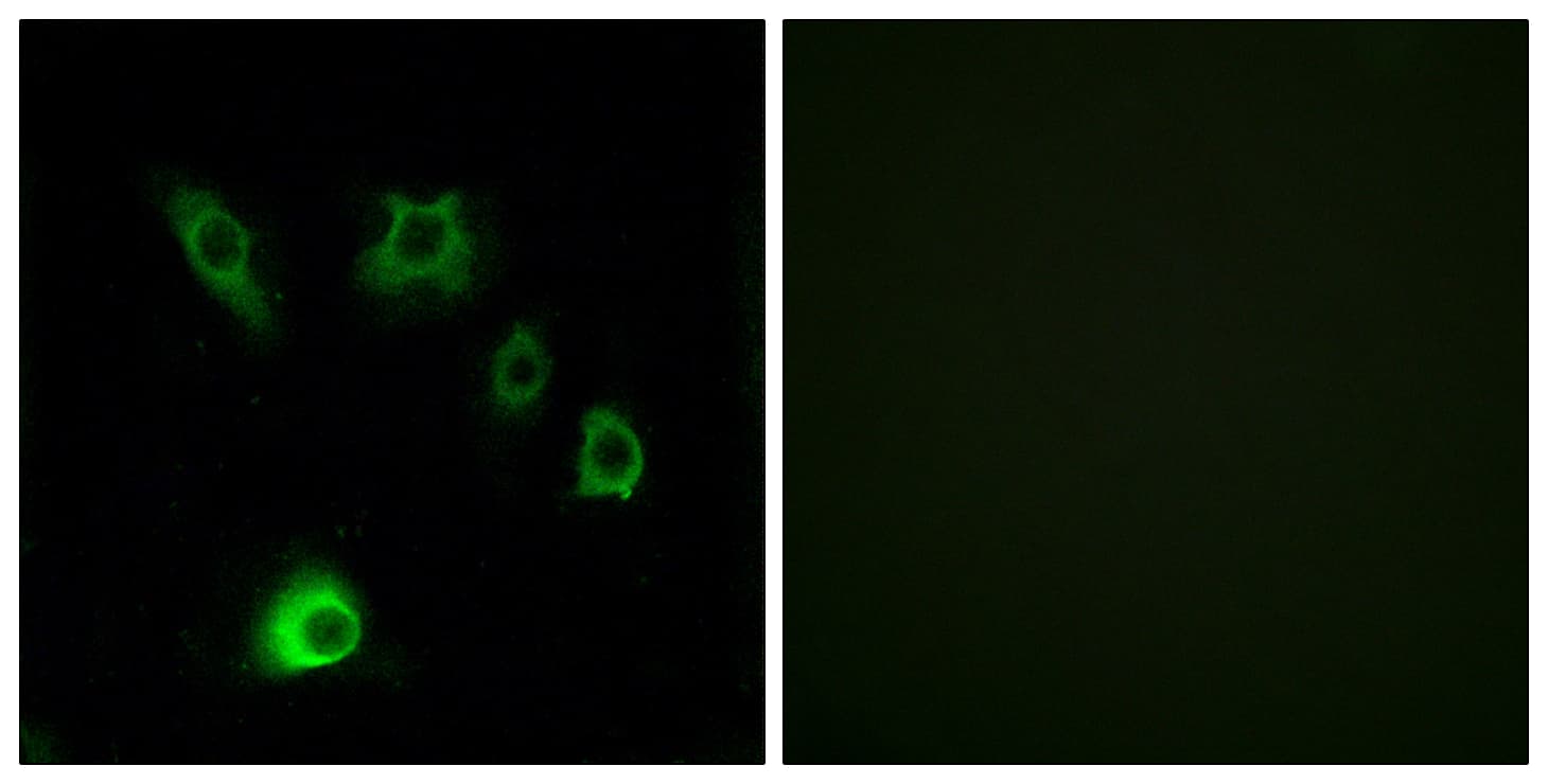 IHC-plus™ FGF18 Antibody (aa151-200)