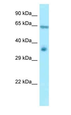 RANGAP1 Antibody (aa163-212)