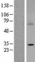 BTG3 Protein (Over-Expression Lysate Myc-DDK (Flag))