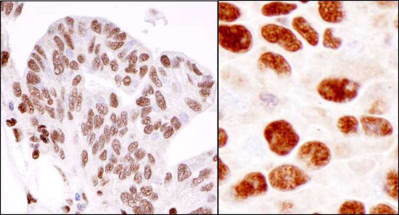 Polyclonal Rabbit anti-Human HNRNPK / hnRNP K Antibody (C-Terminus, IHC, WB)