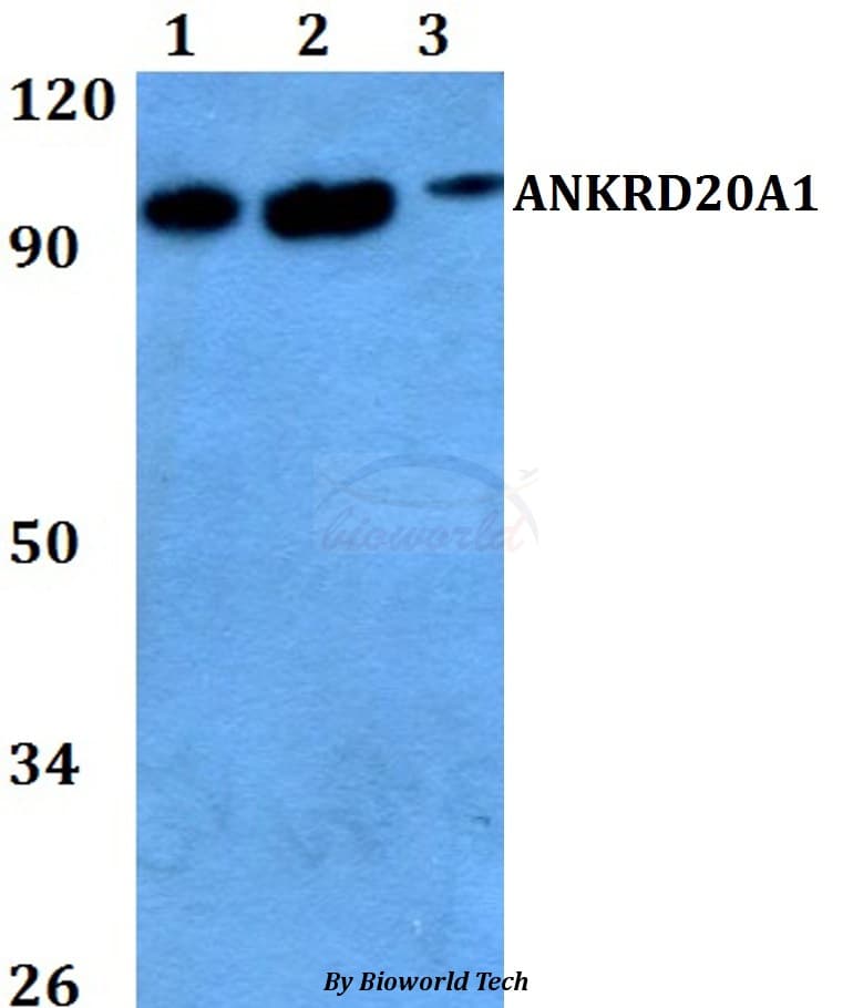 ANKRD20A1 Antibody