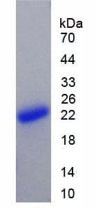 Human BAFF / TNFSF13B Protein (Recombinant His)