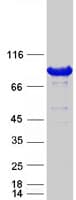 Human OSBP Protein (Recombinant Myc-DDK (Flag))