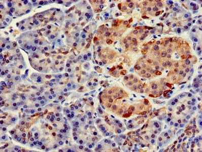 Polyclonal Rabbit anti-Human FARP2 / FRG Antibody