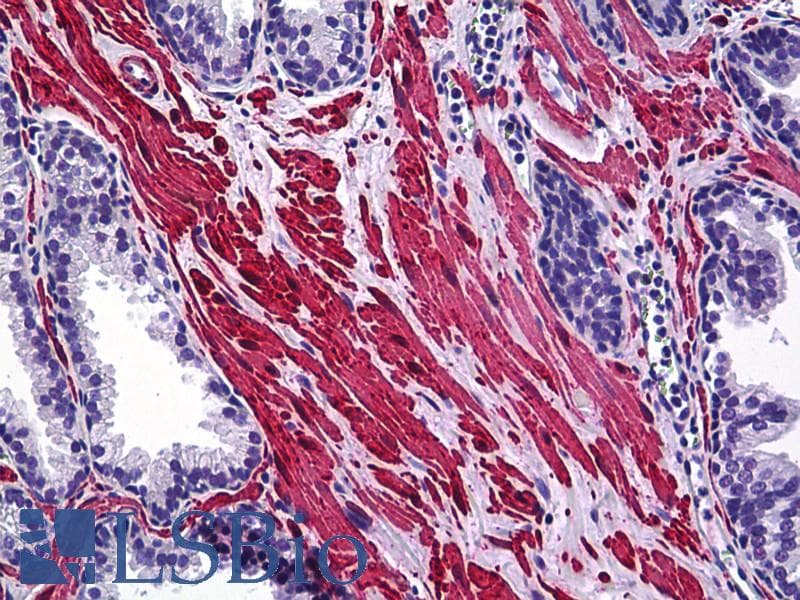 IHC-plus™ SMURF1 Antibody (clone 1D7)