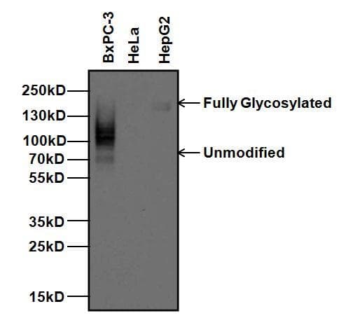 CEACAM5 / CD66e Antibody (clone 1106)