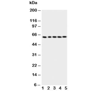 TP63 / p63 Antibody (aa664-680)
