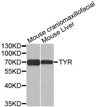 Tyrosinase Antibody