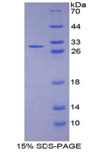 Human FBLN1 / Fibulin 1 Protein (Recombinant His)