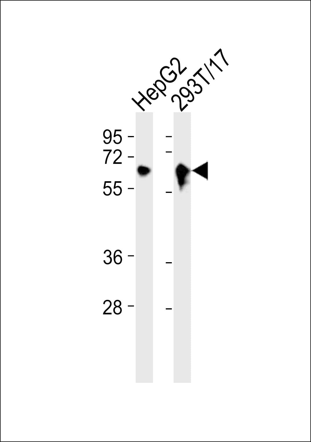 ARSE / Arylsulfatase E Antibody (aa141-200)