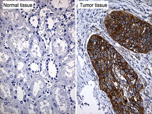 Monoclonal Mouse anti-Human TRIM29 Antibody (clone OTI8D12, aa1-352, IHC, WB)