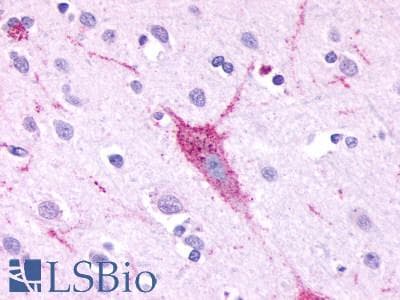 PathPlus™ Polyclonal Rabbit anti-Human GPR61 Antibody (C-Terminus, IHC)